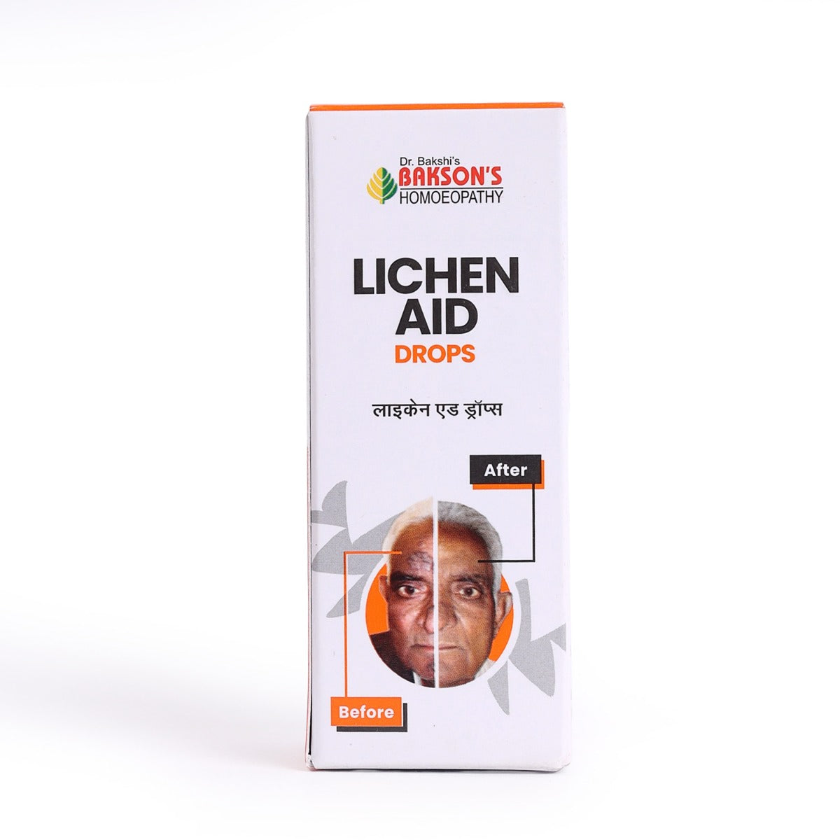 Lichen Aid Drops- 30 ML