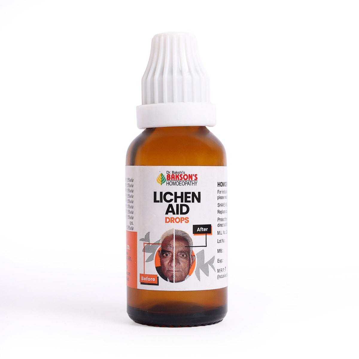 Lichen Aid Drops- 30 ML