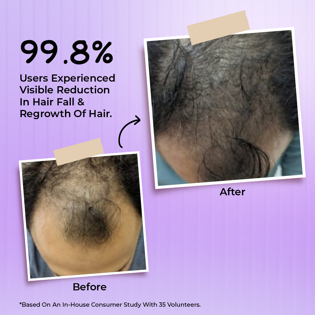 Bakson Hair Reviver | Hair Care & Regrowth Treatment 100ml