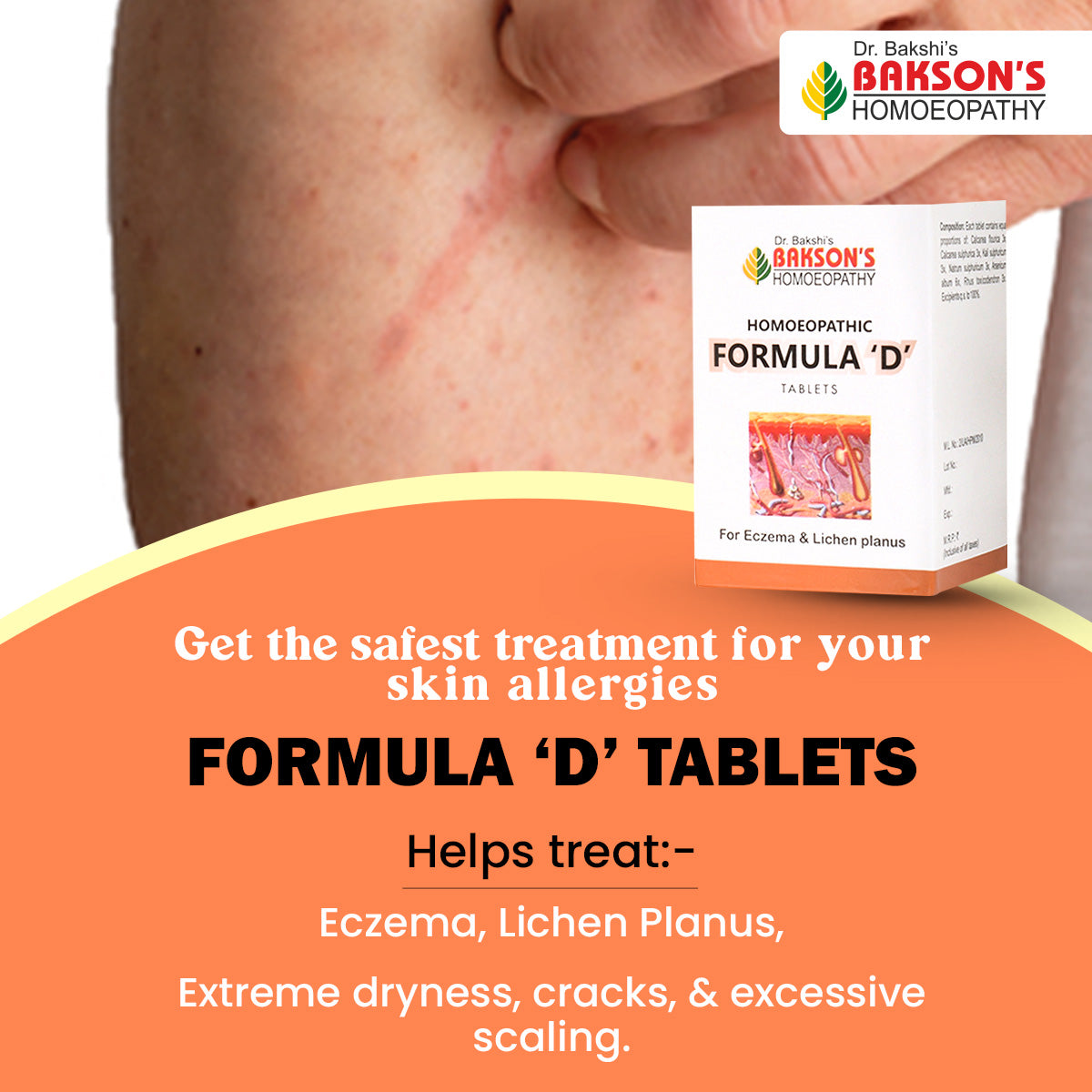 HOMOEOPATHIC FORMULA 'D' TABLETS-40TABS (M)