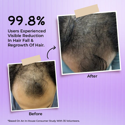 Bakson Hair Reviver | Hair Care & Regrowth Treatment 100ml