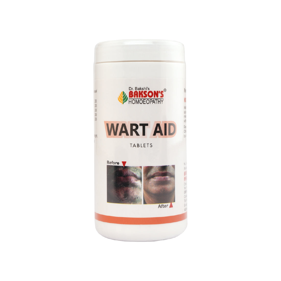 WART AID TABLETS