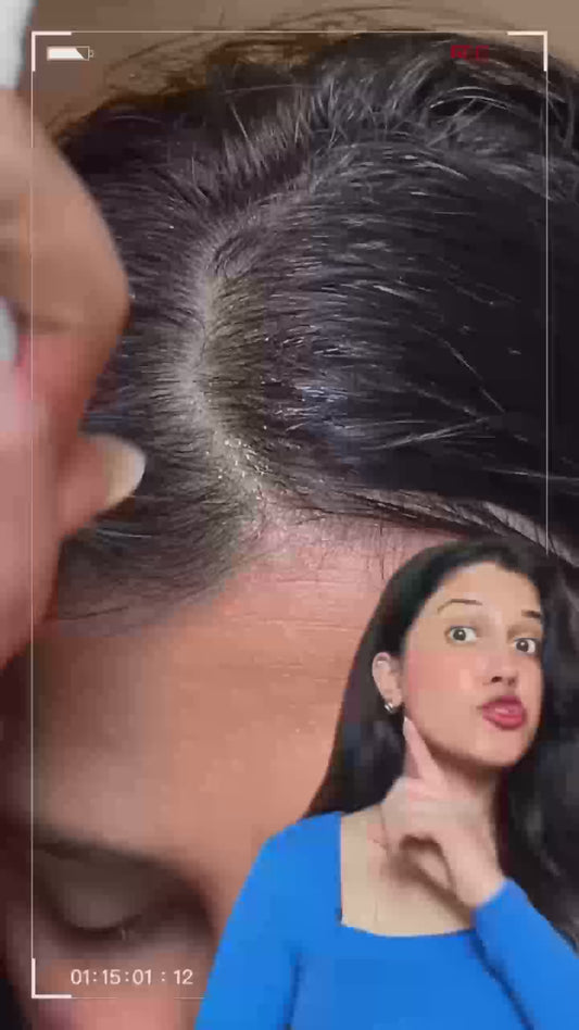 Bakson Hair Reviver | Hair Care & Regrowth Treatment 100ml
